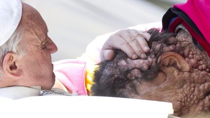 Le pape FRan&ccedil;ois caresse la t&ecirc;te d'un homme atteint d'une maladie lors d'une audience place Saint-Pierre (Vatican), le 6 novembre 2013. (MAXPPP)