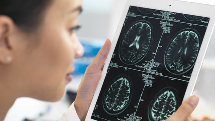 Alzheimer : l'intelligence artificielle au secours de la recherche