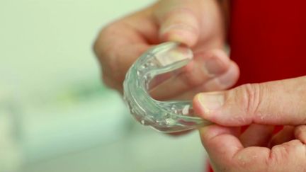 Santé : les orthodontistes inquiets des appareils dentaires disponibles sur Internet