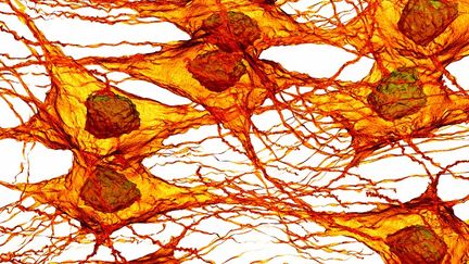 Des cellules canc&eacute;reuses.&nbsp;Les cellules souches canc&eacute;reuses seraient &agrave; l'origine de la croissance d'une tumeur. (PASIEKA / AFP)