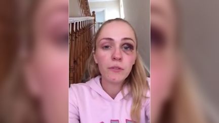 Emma Murphy, une jeune Irlandaise, a post&eacute;, le 7 juillet 2015, une vid&eacute;o sur sa page Facebook, dans laquelle elle d&eacute;nonce les violences conjugales. (EMMA MURPHY / FACEBOOK)