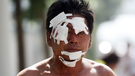 Un homme bless&eacute; marche dans une zone r&eacute;sidentielle de Tianjin &agrave; proximit&eacute; du site des explosions, le 13 ao&ucirc;t 2015. (GREG BAKER / AFP)