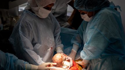 Des médecins donnent naissance à un bébé à Kharkiv (Ukraine), le 21 juillet 2022. (WOLFGANG SCHWAN / ANADOLU AGENCY / AFP)