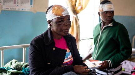 Des survivants du cyclone Idai, blessés et hospitalisés à Chimanimani, dans l'est du Zimbabwe, le 18 mars 2019. (ZINYANGE AUNTONY / AFP)