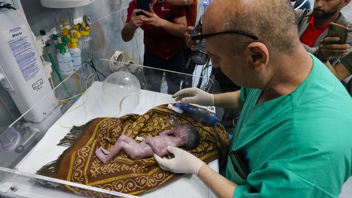 Un médecin palestinien soigne le bébé de Sabreen al-Sakani, grièvement blessée lors d'une frappe aérienne israélienne à Gaza le 20 avril 2024. La petite fille, seule survivante de sa famille, a été sauvée par césarienne alors que sa mère mourait. (MOHAMMED ABED / AFP)