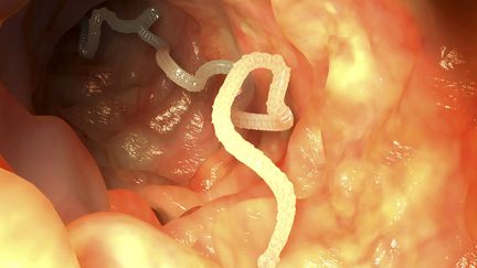 Photo d'illustration d'un vers intestinal. (JUAN GARTNER / SCIENCE PHOTO LIBRARY RF)