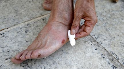 Les ampoules, foulures et autres coupures sont plus fréquentes lorsque l'on porte des chaussures d'été ouvertes, plates et légères. (GODONG / BSIP / AFP)