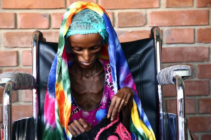 Saïda Ahmad Baghili, 18 ans, est assise sur une chaise roulante dans un hôpital à Hodeïda au Yémen, où elle était soignée pour malnutrition sévère, le 25 octobre 2016.&nbsp; (STRINGER / AFP)