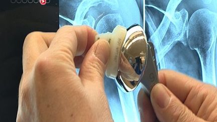 Implants médicaux : une enquête internationale dénonce d'importantes lacunes dans les contrôles