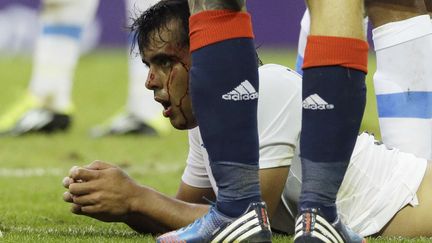 Le sang coule sur le visage de l'uruguayen Diego Rodriguez, lors du match de football entre l'Angleterre et l'Uruguay, au Millennium Stadium &agrave; Cardiff, au Pays de Galles, lors des Jeux olympiques d'&eacute;t&eacute; de 2012 &agrave; Londres. (LUCA BRUNO / SIPA )