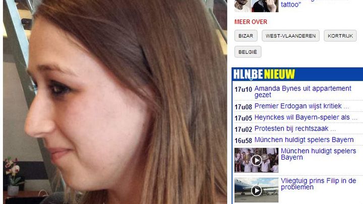 Capture d'&eacute;cran du site belge hln.be, montrant&nbsp;le visage de&nbsp;Kimberley Vlaeminck apr&egrave;s son traitement au laser, le 1er juin 2013. (HLN.BE / FRANCETV INFO)