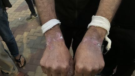 Ayman shows his bruised wrists after incarceration in an Israeli prison.  November 2023, Ramallah (West Bank).  (GILLES GALLINARO / RADIOFRANCE)