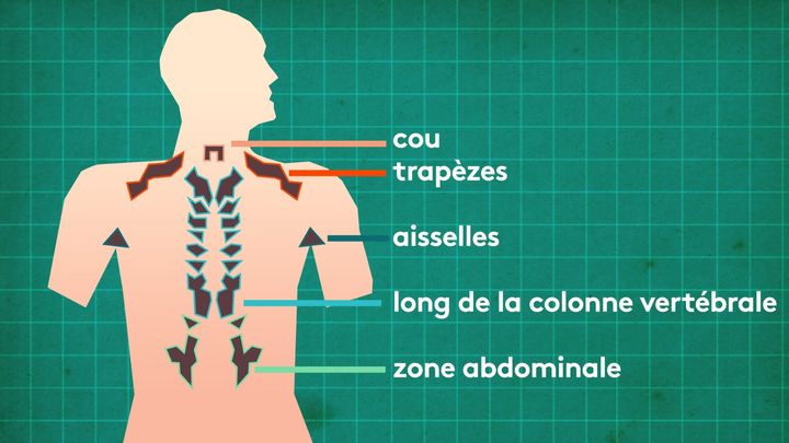 La "graisse brune" est naturellement stockée dans différentes parties du corps à l'âge adulte. (STEPHANIE BERLU / FRANCEINFO)