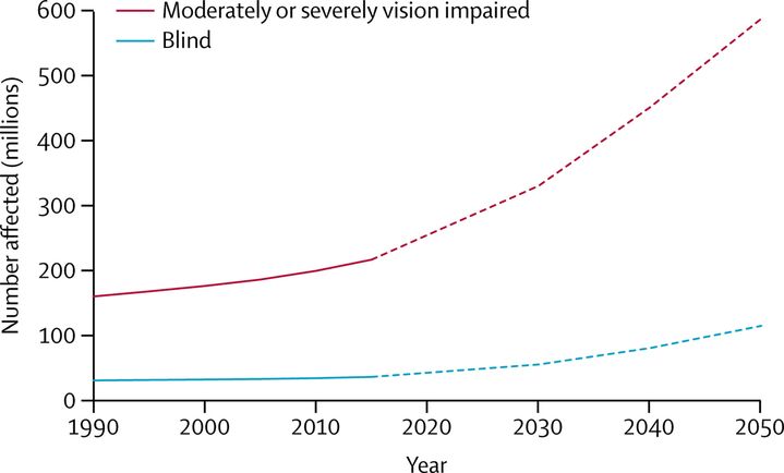 Une vingtaine de chercheurs ont appliqué un modèle mathématique à des données pour anticiper la hausse du nombre d'aveugles (en bleu) et de déficients visuels (en rouge) dans le monde, d'ici à 2050. (RUPERT R A BOURNE / THE LANCET GLOBAL HEALTH)
