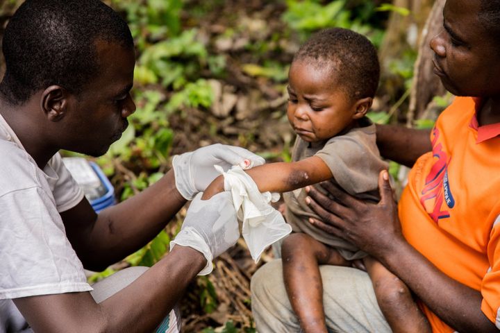 Un enfant atteint de la variole du singe, tenu par son père, est soigné dans un centre de Médecins sans Frontières (MSF) près de Lobaya,&nbsp;dans le sud-ouest de la Centrafrique, le 18 octobre 2018. (CHARLES BOUESSEL / AFP)