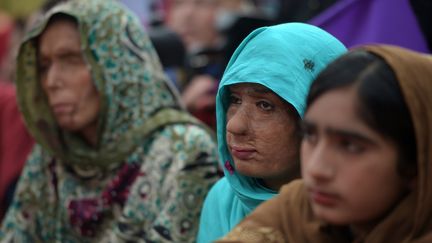 Pakistan : des survivantes d'attaques à l'acide participent à une manifestation pour la journée internationale des droits des emmes à Islamabad, le 8 mars 2019.&nbsp; (AAMIR QURESHI / AFP)