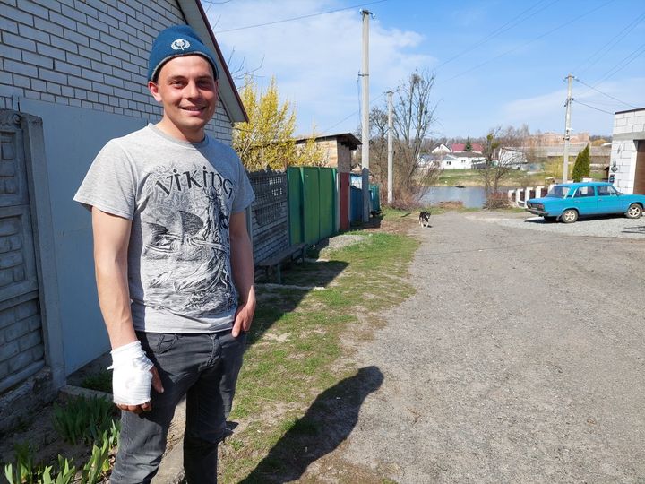 Anatole, 23 ans, a subi des violences à Druzhnya : arrêté par des soldats russes, il a été interrogé et ont tiré dans sa main droite, aujourd'hui bandée. (JEREMY TUIL / RADIO FRANCE)