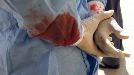 Les mains d'un médecin au service des urgences de l'hôpital de Dara, en mars 2011. (ANWAR AMRO/AFP)