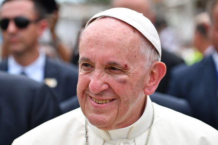 Le&nbsp;pape François portant un hématome près de l'œil gauche&nbsp;à&nbsp;Carthagène&nbsp;(Colombie), le 10 septembre 2017 (ALBERTO PIZZOLI / AFP)