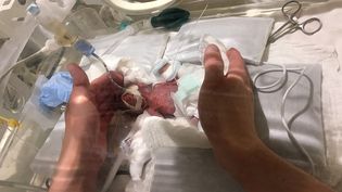 Video Californie Le Plus Petit Bebe Ne En Vie Au Monde Quitte L Hopital Apres Cinq Mois De Soins