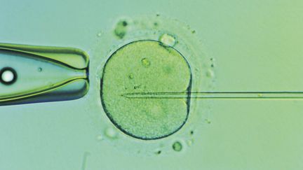 L'Assembl&eacute;e nationale examine, jeudi 28 mars, une proposition de loi visant &agrave; autoriser, sous certaines conditions, la recherche sur l'embryon et les cellules souches embryonnaires. (SUPERSTOCK / SIPA)