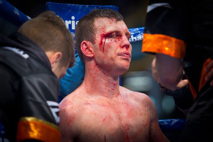 Le boxeur australien Jeff Horn lors de son combat contre Manny Pacquiao au Suncorp Stadium de Brisbane (Australie), dimanche 2 juillet 2017. (PATRICK HAMILTON / AFP )